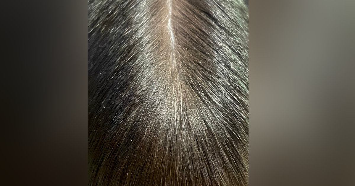 『人間の頭頂部』かと思いきや……信じられない『まさかの正体』に３万いいね「いや頭頂部でしょｗ」「とんでもない花火に見えた」