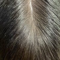 人の頭頂部のような写真