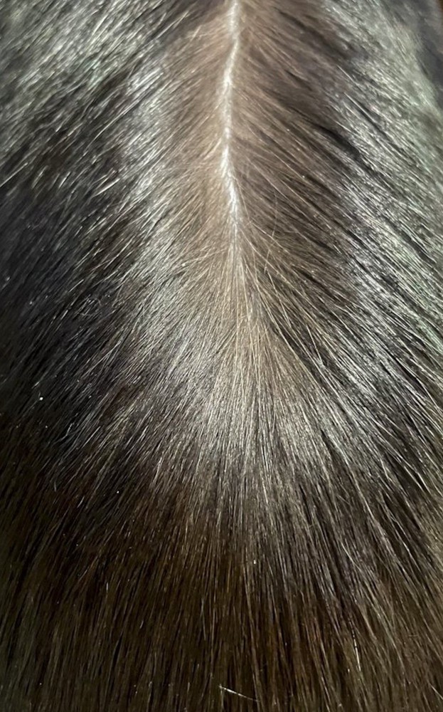 人の頭頂部のような写真