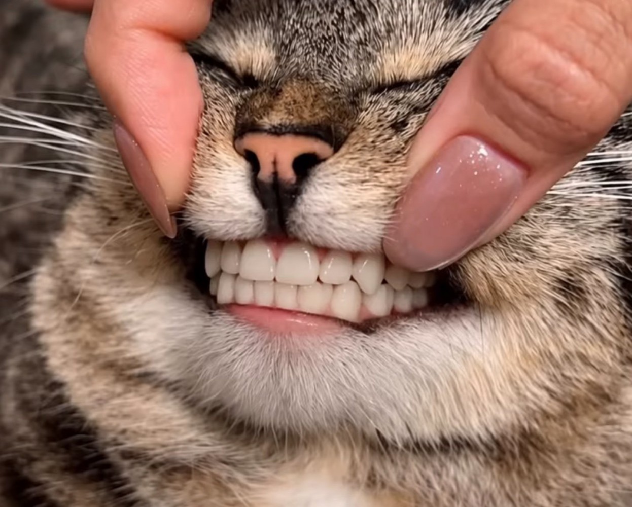 人間の歯