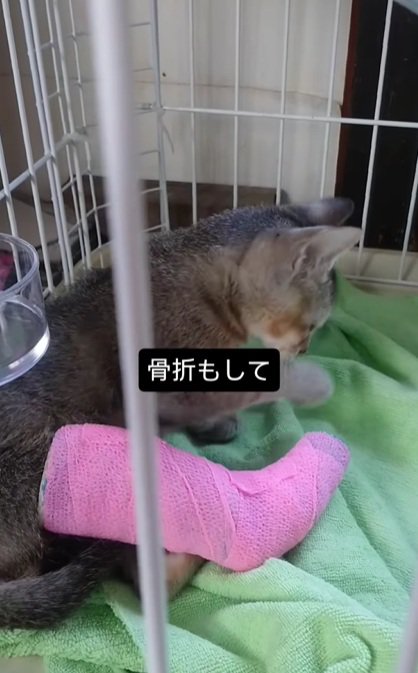 ギプス