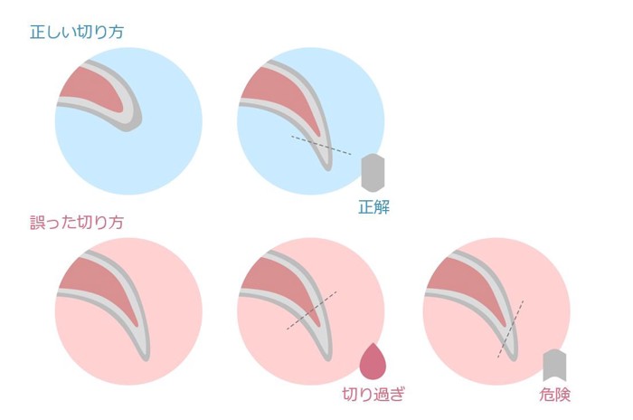 猫の爪の切り方