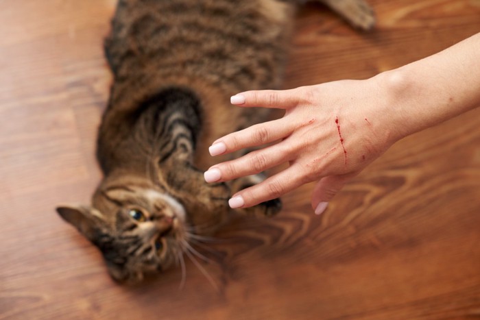 猫に引っ掻かれた手