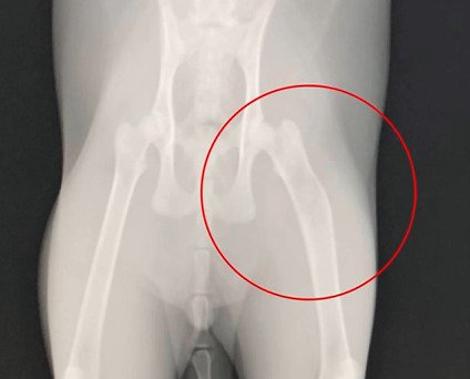 レントゲン写真