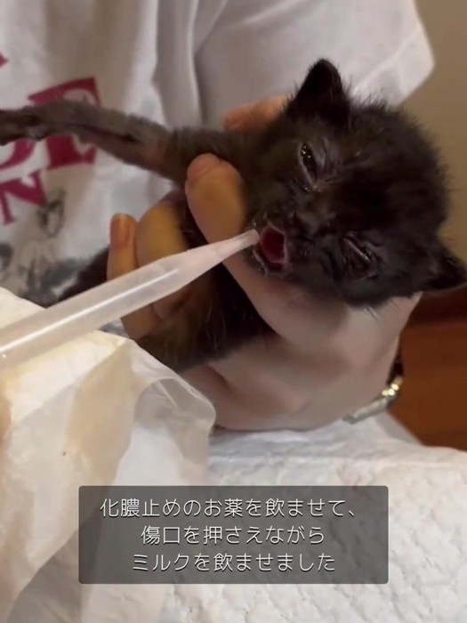 スポイトでミルクを飲ませてもらう子猫