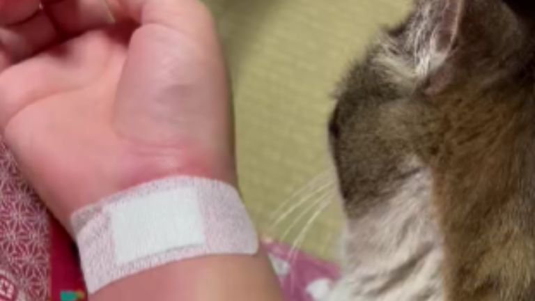 ケガしている腕と猫