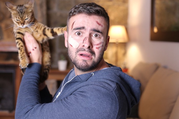 猫に顔をひっかかれた男性