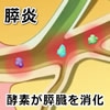 意外と多い病気「膵炎」が忍び寄る時・・・