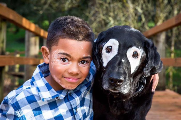 【世界中で話題！】白斑の犬「ロウディ」と出会った白斑の少年の物語