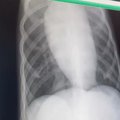 病気にかかった状態…