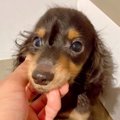 重度の水頭症で『1歳…