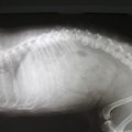 キアリ様奇形とは小…
