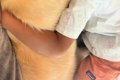 男の子が発熱し、お…の画像