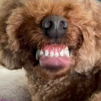 歯茎モンスターのえるもくん3