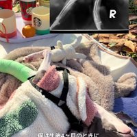 骨折してしまった…