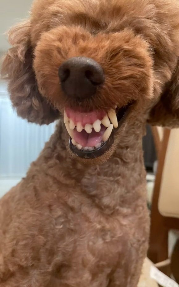 歯茎モンスターのえるもくん2