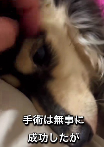 手術は無事に成功