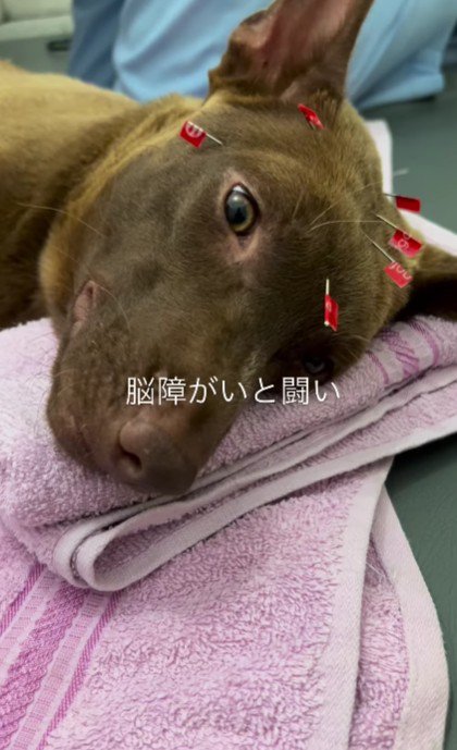 脳障害との戦いが始まった