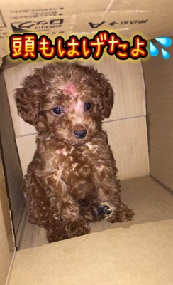 頭がはげたことも…