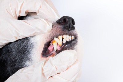 歯を診る、白い手袋