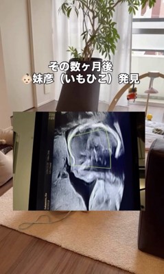 ママのお腹に赤ちゃんが…!