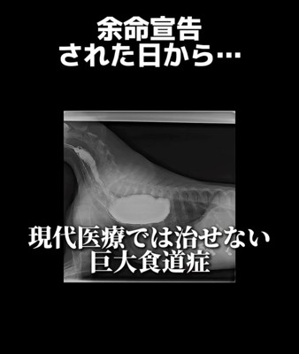 レントゲン写真