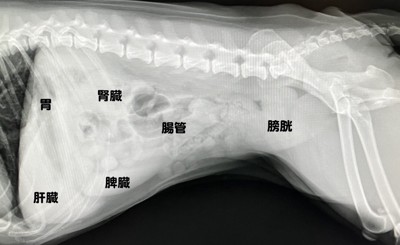 腹部X線画像