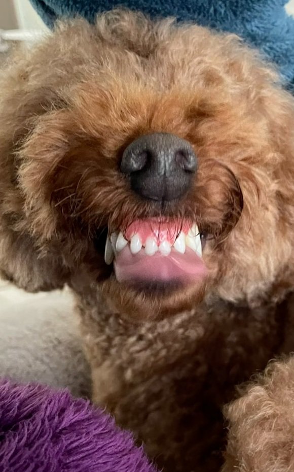 歯茎モンスターのえるもくん3