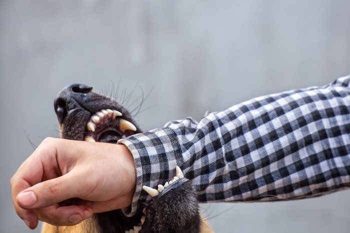 腕を噛もうとする犬