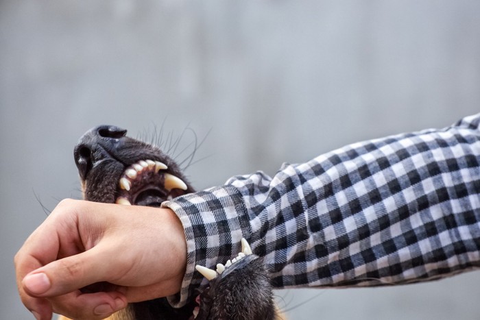 人の手首を噛む犬の口元