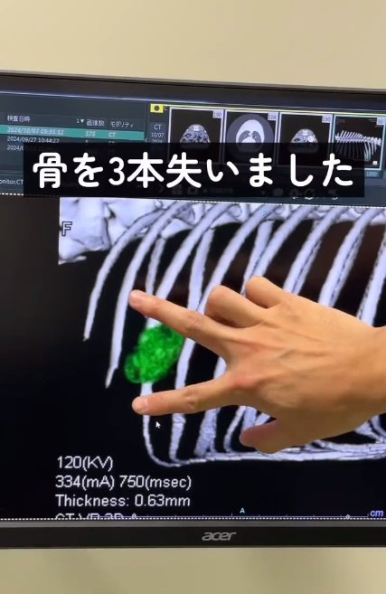 銀次郎くんの病理画像