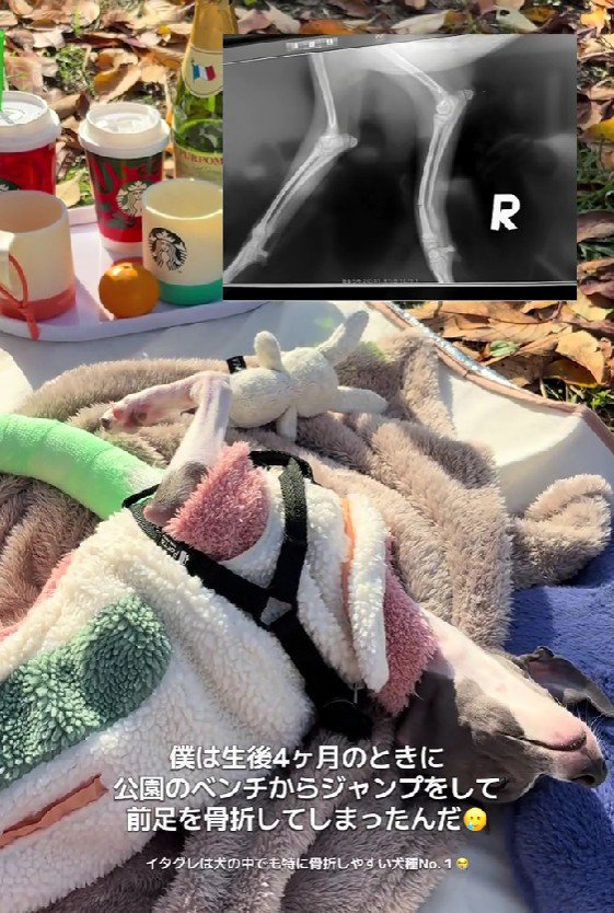 骨折してしまった…