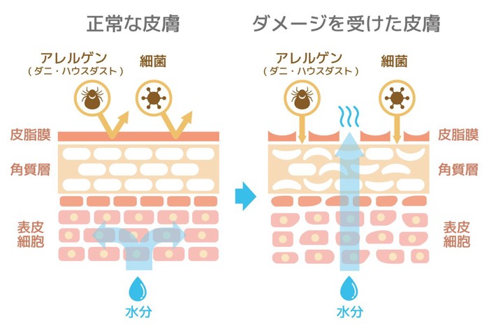 皮膚の断面図