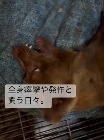 痙攣発作が止まらない