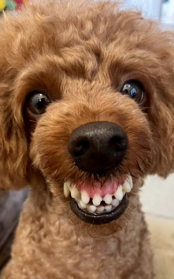 歯茎モンスターのえるもくん1