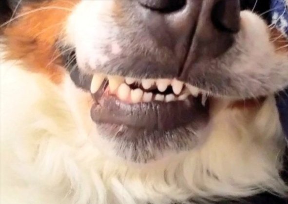 歯