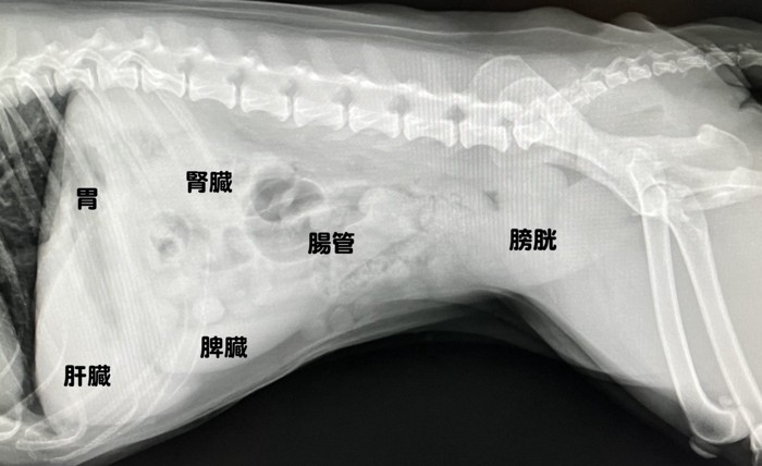 腹部X線画像