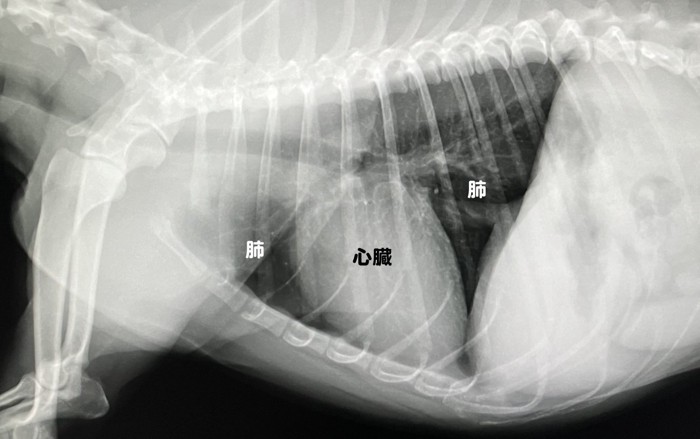 胸部X線画像