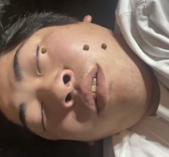 顔の上に並べられた複数のおやつ